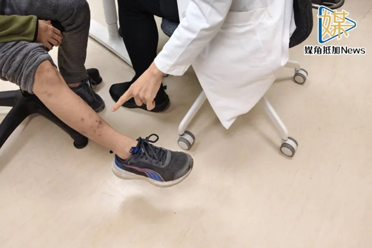 清明掃墓防恙蟲　醫提醒三招自保